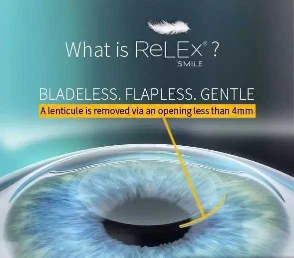 Relex Smile Eye Laser Turkey The More Clinics