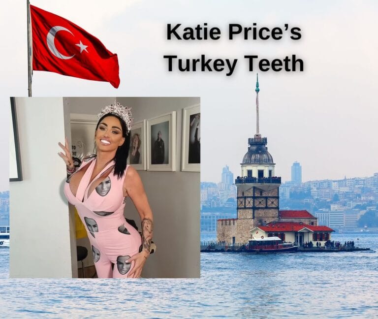 Katie Price’s Turkey Teeth: Exploring Whole Story